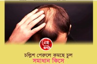 চল্লিশ-পেরুলে-কমছে-চুল--সমাধান-কিসে