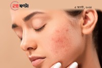 ব্রণ-কমাতে-কি-কাণ্ডই-না-করতেন-লাস্যময়ী-তামান্না