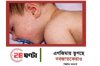 এগজিমায়-ভুগছে-নবজাতকেরাও